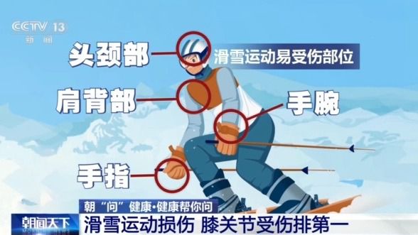 季滑雪请收下这份安全指南！新利娱乐选护具、防摔跤 冬(图4)